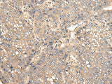 VTI1B Polyclonal Antibody Reactivity Human, Biomarkers, Elabscience Biotechnology, MSE Supplies
