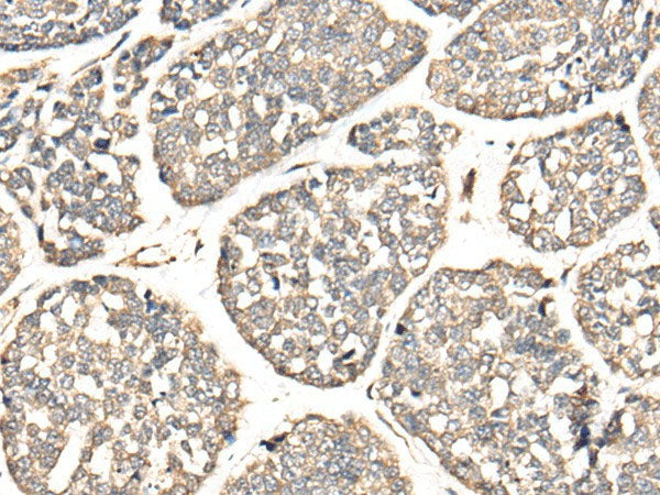 VTI1B Polyclonal Antibody Reactivity Human