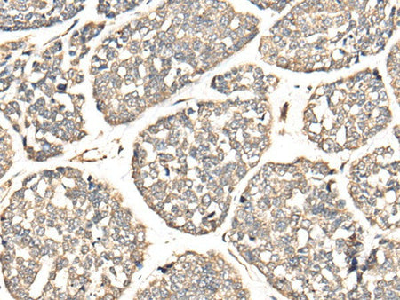 VTI1B Polyclonal Antibody Reactivity Human