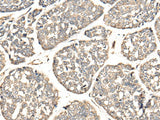 VTI1B Polyclonal Antibody Reactivity Human
