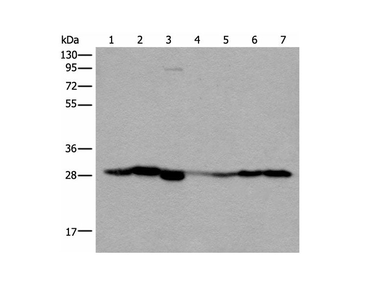 VTI1B Polyclonal Antibody Reactivity Human