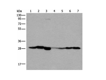 VTI1B Polyclonal Antibody Reactivity Human