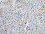 VWA2 Polyclonal Antibody