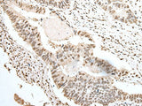 SNRPA Polyclonal Antibody Reactivity Human