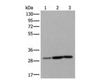 SNRPA Polyclonal Antibody Reactivity Human