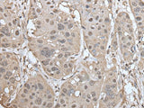 UBASH3A Polyclonal Antibody