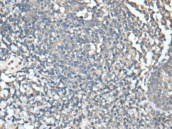 UBASH3A Polyclonal Antibody