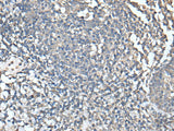 UBASH3A Polyclonal Antibody
