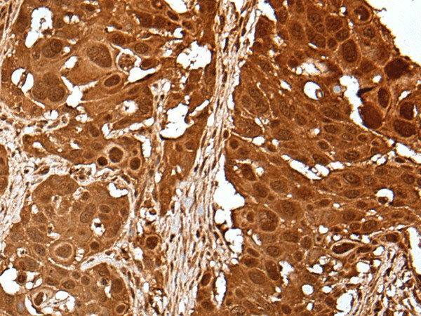 UBE2V1 Polyclonal Antibody Reactivity Human