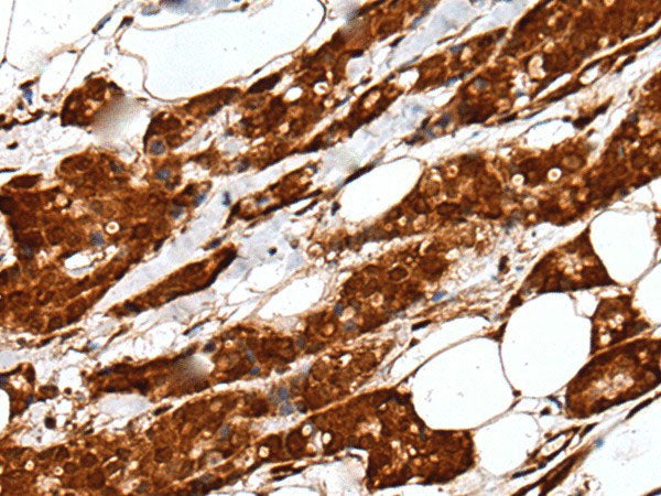 UBE2V1 Polyclonal Antibody Reactivity Human