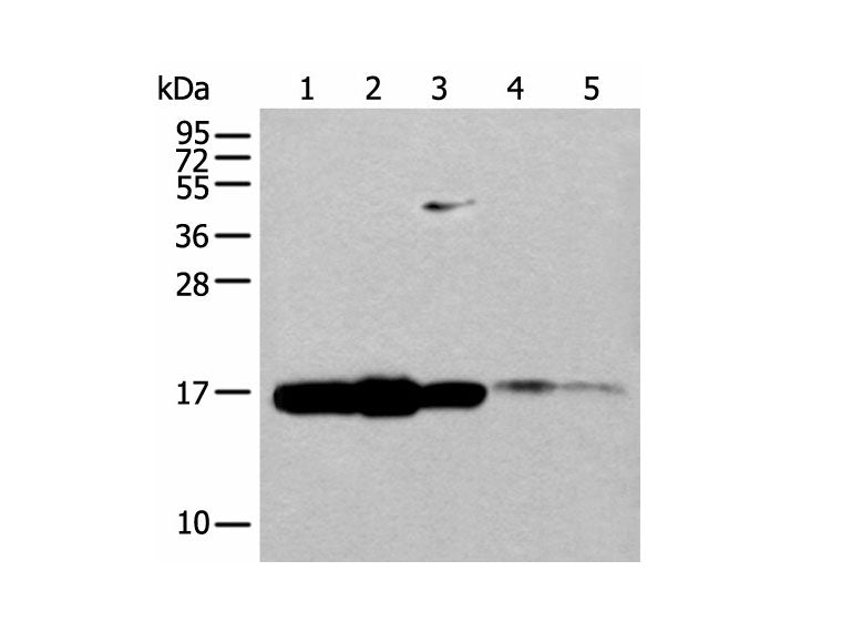 UBE2V1 Polyclonal Antibody Reactivity Human