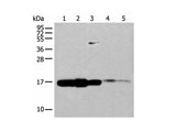 UBE2V1 Polyclonal Antibody Reactivity Human
