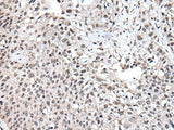 UBE2E3 Polyclonal Antibody