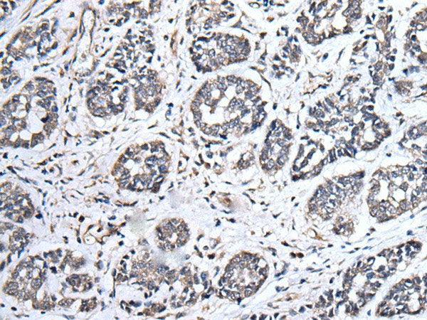 UBE2E3 Polyclonal Antibody