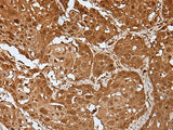 UBA7 Polyclonal Antibody