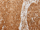 UBA7 Polyclonal Antibody