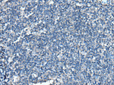 UFC1 Polyclonal Antibody Reactivity Human