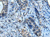 UFC1 Polyclonal Antibody Reactivity Human