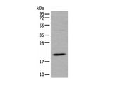 UFC1 Polyclonal Antibody Reactivity Human