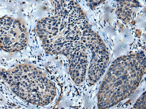 ULK4 Polyclonal Antibody