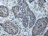 ULK4 Polyclonal Antibody
