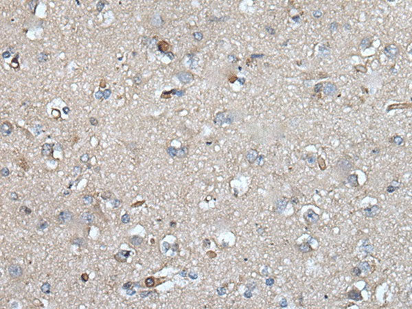 UMPS Polyclonal Antibody Reactivity Human