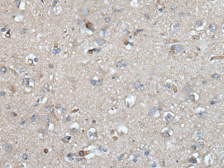 UMPS Polyclonal Antibody Reactivity Human