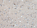 UMPS Polyclonal Antibody Reactivity Human