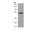 UMPS Polyclonal Antibody Reactivity Human