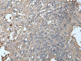 UNC13B Polyclonal Antibody Reactivity Human