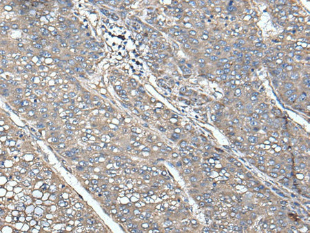 UNC13B Polyclonal Antibody Reactivity Human