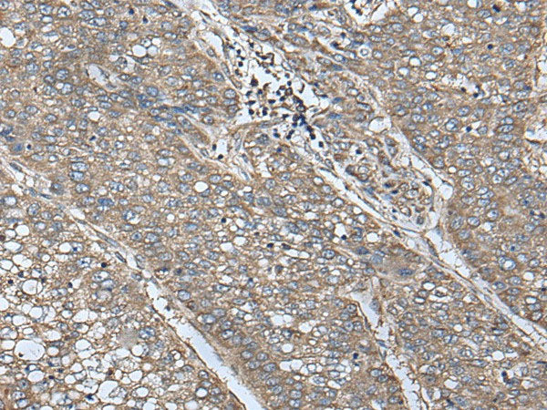UQCRQ Polyclonal Antibody Reactivity Human