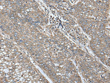 UQCRQ Polyclonal Antibody Reactivity Human