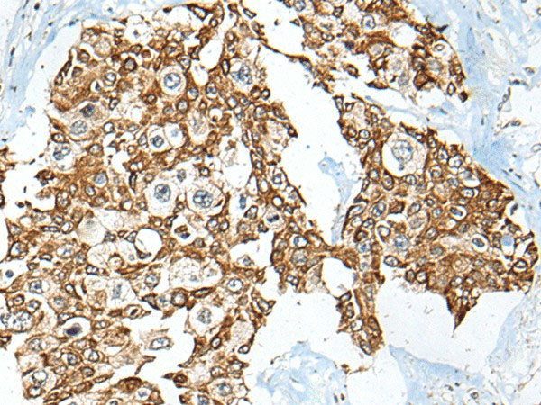 USP12 Polyclonal Antibody Reactivity Mouse