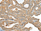 USP12 Polyclonal Antibody Reactivity Mouse