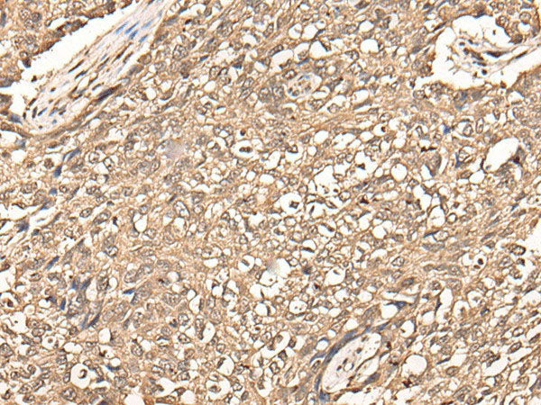 USP21 Polyclonal Antibody Reactivity Human