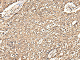 USP21 Polyclonal Antibody Reactivity Human