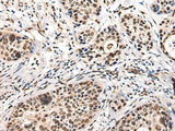 USP6NL Polyclonal Antibody Reactivity Human