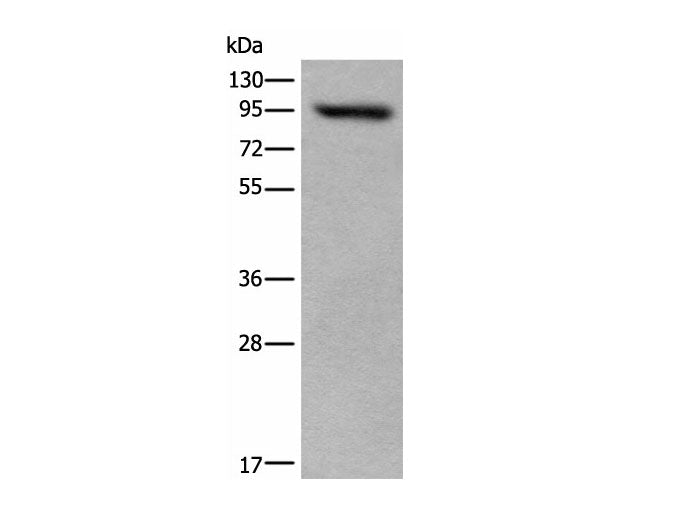 USP6NL Polyclonal Antibody Reactivity Human