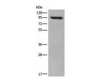 USP6NL Polyclonal Antibody Reactivity Human