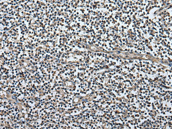 UTP3 Polyclonal Antibody Reactivity Human