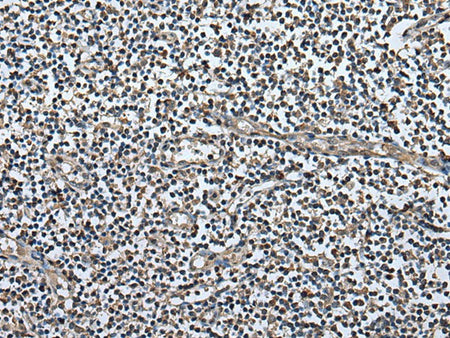 UTP3 Polyclonal Antibody Reactivity Human