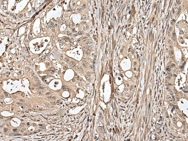 UTP3 Polyclonal Antibody Reactivity Human