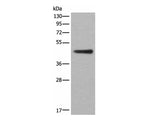 ASS1 Polyclonal Antibody Reactivity Human