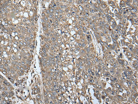 ATAD1 Polyclonal Antibody Reactivity Human