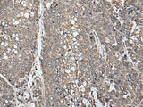 ATAD1 Polyclonal Antibody Reactivity Human