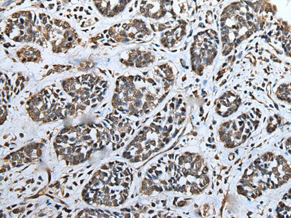 ATAD1 Polyclonal Antibody Reactivity Human
