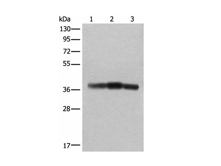 ATAD1 Polyclonal Antibody Reactivity Human