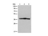 ATAD1 Polyclonal Antibody Reactivity Human