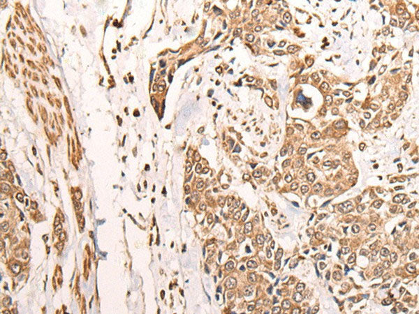 ATAD3A Polyclonal Antibody Reactivity Human